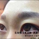 썬스킨