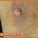 헐렁이