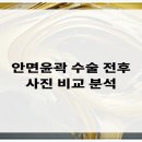비티성형외과의원 이미지