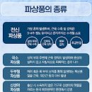 파상풍 초기증상 예방접종 (주사) 이미지