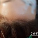 수경헤어라인 이미지