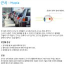 VISION(비젼)안경콘택트 이미지