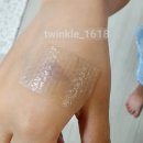 [화상치료] 손등화상 후기
