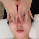 연세나무병원 | 천안 불당동 피부관리 비스킨랩 - 작은얼굴관리 후기