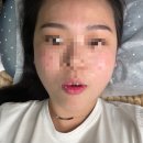 김천 예신관리는 로건뷰티샵에서! 원쎄라+패디플래닝 후기