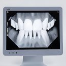 착한미소치과의원 | 치과 공포증 극복 챌린지 대성공 후기