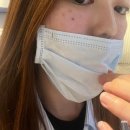 신논현역피부과 리쥬란힐러 2CC 후기 손주사 엠보 1~7일 비교