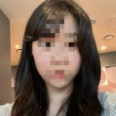 한사람 | 후기(안면윤곽 전문 2곳 상담 후기 + 공장형병원 후기) | 실제 광대축소 한 사람 후기 | 광대 윤곽...
