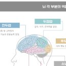 뇌종양 초기 전조증상 양성 두통 원인 및 치료 이미지