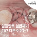임플란트 가격보다 중요한 선택 기준 후기