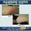 헐렁이