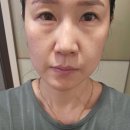 브이라인 마스크팩 , 씨에이치쓰리 더블 업 리프팅 프리미엄 마스크