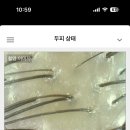 건강두피모발관리 이미지