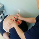 생활건강테이핑 이미지