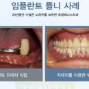 제니스치과기공소 이미지