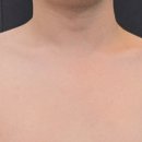 차오름의원 이미지