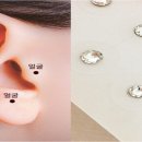 복합형 스마트폴(8) | 살 빼는 귀침 논란의 진실, 귀씨침술이 진짜 효과 있는 이유는?