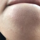 피지연화앰플 연화제 후기 주기 사용방법