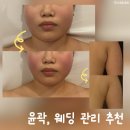 커피빈목동점 | 목동작은얼굴만들기 컨투어페이스바디 끌리메목동점 후기