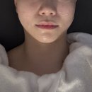 세하에스테틱 | 강남에스테틱 피부관리 < 로에스떼 > 인텐스 울트라 후기