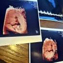 노블클라쎄산부인과의원 이미지