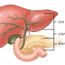 담낭 및 담관암 (gallbladder cancer, cholangiocarcinoma) 쓸개암 이미지