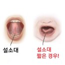 임방울대로 | 광주 소아과 신생아 BCG 접종 &amp; 1차 영유아검진 후기 | 설소대 단축증 수술 (+ 보험청구)