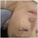 아이스킨 이미지