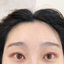 잇두