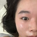 에소코핏 수원인계점