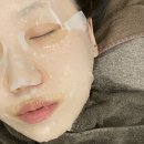 젠틀멍 | 의정부 피부과 젠틀맥스프로 잡티레이저 효과 후기