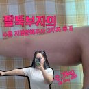 집밥멍선생 | 수원 지방분해주사 3회차 후기, 지방분해주사 팔뚝 라인 변화와 통증