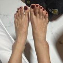 둔내한의원 | 절름발이의 죶같았던 크리스마스,,