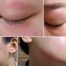 칠곡가톨릭피부과의원 이미지