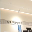 뿌리깊은치과의원 | 판교역 수내역 치과 2차 충치는 무조건 발치? 정답 알려드립니다