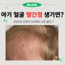 청담포워드피부과의원 네이버블로그