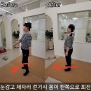 쏠리만 | 평택 한쪽으로 계속 쏠리는 몸, 좌우 불균형 교정 후기