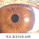 신경선 이미지
