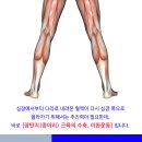 손과 발이 차고 종아리에 통증이 있다면? 이미지