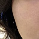 리베리의원 | 병점 리베리의원 2회차 솔직 후기｜얼굴제모 &amp; 광채관리 가격까지 정리