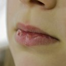 엘바이오 이미지