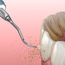 엔젤치과의원 이미지