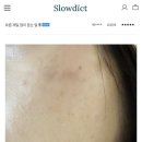 딕트 | 슬로우딕트 후기 감사해요 🙏🏻
