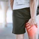 삼성본정형외과의원 이미지