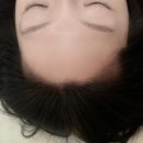 [신촌역 디엘브로우] 헤어라인 내돈내산 후기