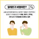 질병 "비염 rhinitis" 이미지