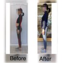 상대동11 | 상대동피티) 체형교정후기 자세의 중요성