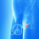 백선세탁 이미지