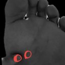 연세힐마취통증의학과의원 | 아픔 /통증 체외충격파 발바닥 근막염 병원 진료 족저근막염 통풍 연세힐마취통증의학과의원 분당 수내