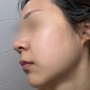 능곡예인의원 이미지